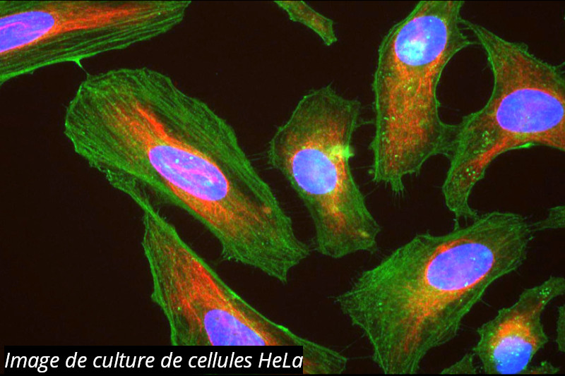 Les cellules HeLa